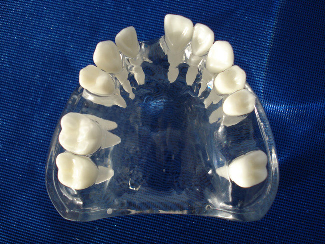 水晶牙列缺失模型（白色牙齿）
