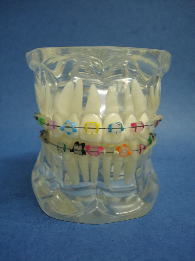 综合正畸水晶牙列模型