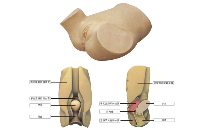 阴道后穹窿穿刺模型
